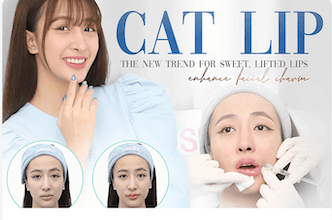 ฟิลเลอร์ปากแมว เทรนด์ใหม่ ปากสวยหวาน เสริมเสน่ห์ให้ใบหน้า