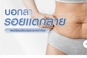 บอกลารอยแตกลาย เผยวิธีลด เลือนรอยแตกหน้าท้องให้ผิวสวย