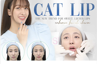 Cat-lip filler: the new trend for sweet, charming lips
